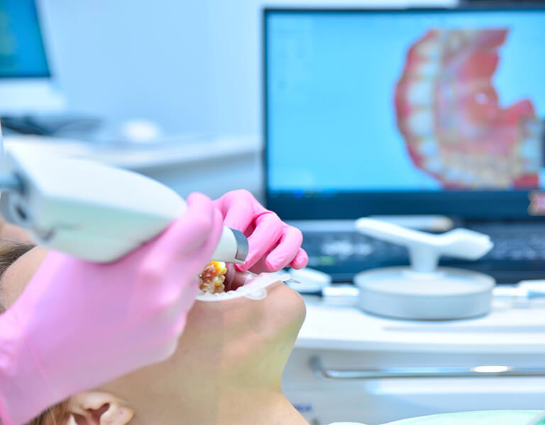 Digital Scanners