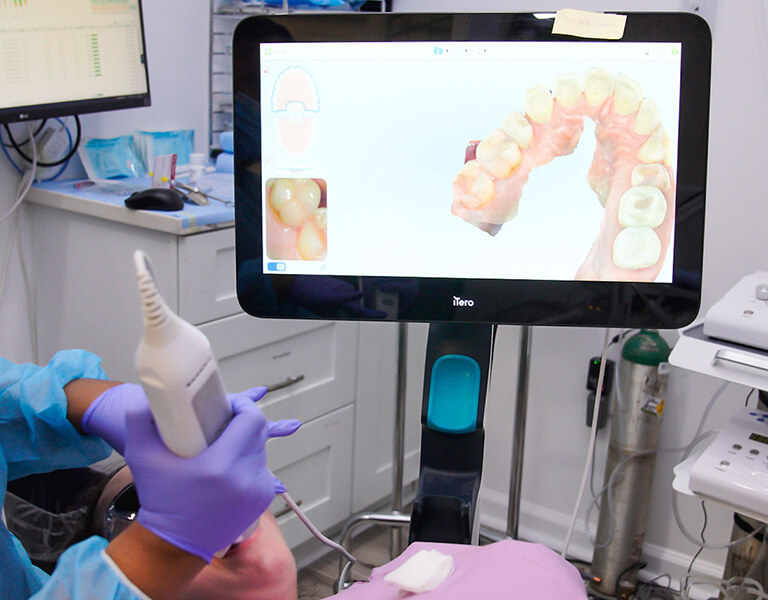 Digital Scanner Device at Karande Biological Dentistry